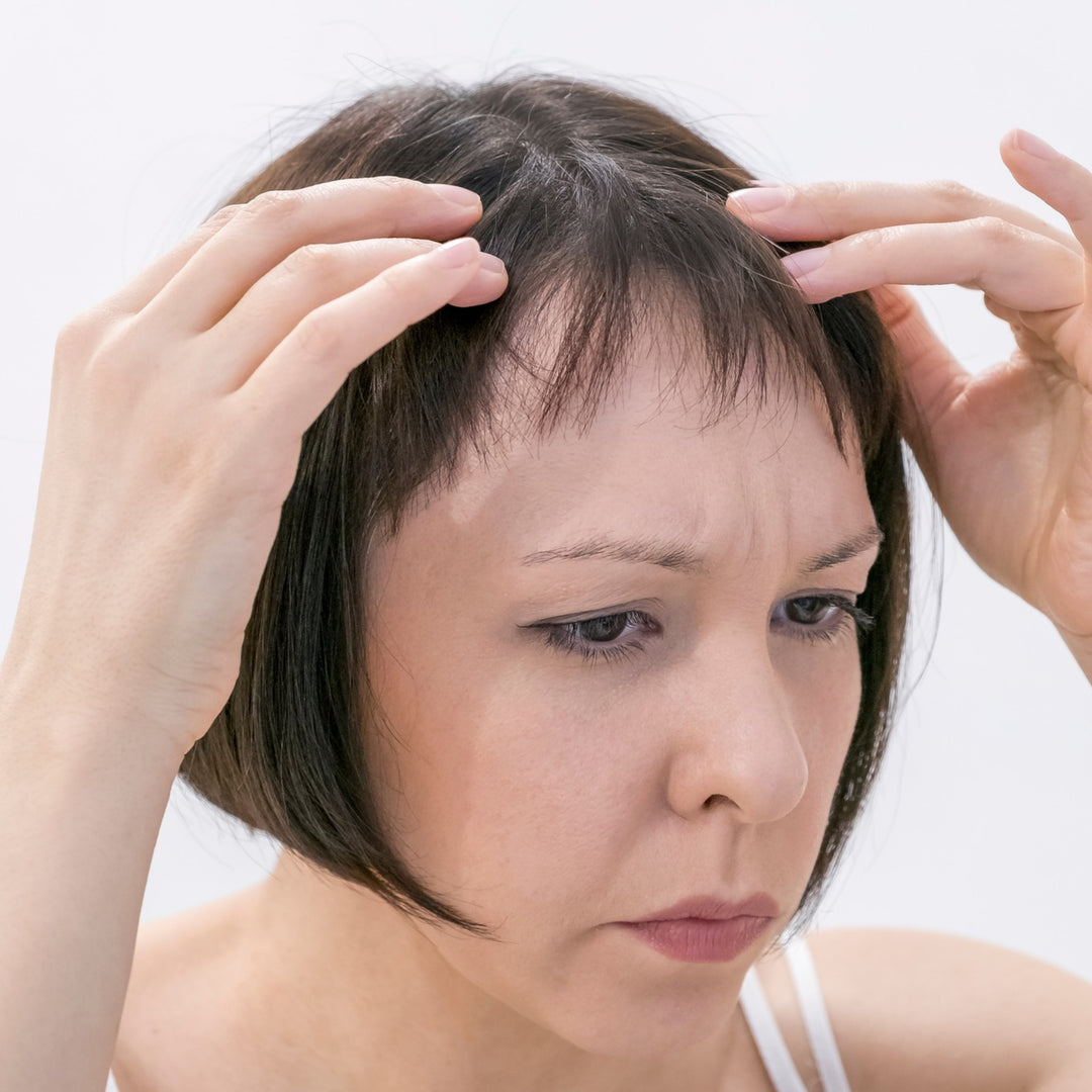 The image shows the top of a person’s head with their hands parting their hair to reveal the scalp.