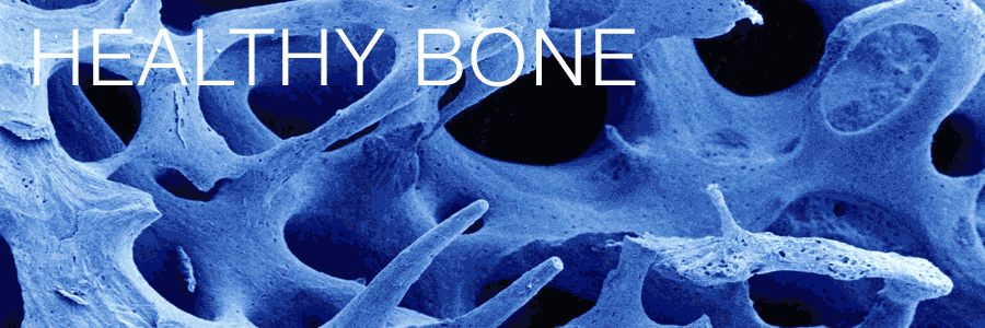 Staying Strong, Bone Health and Osteoporosis Prevention