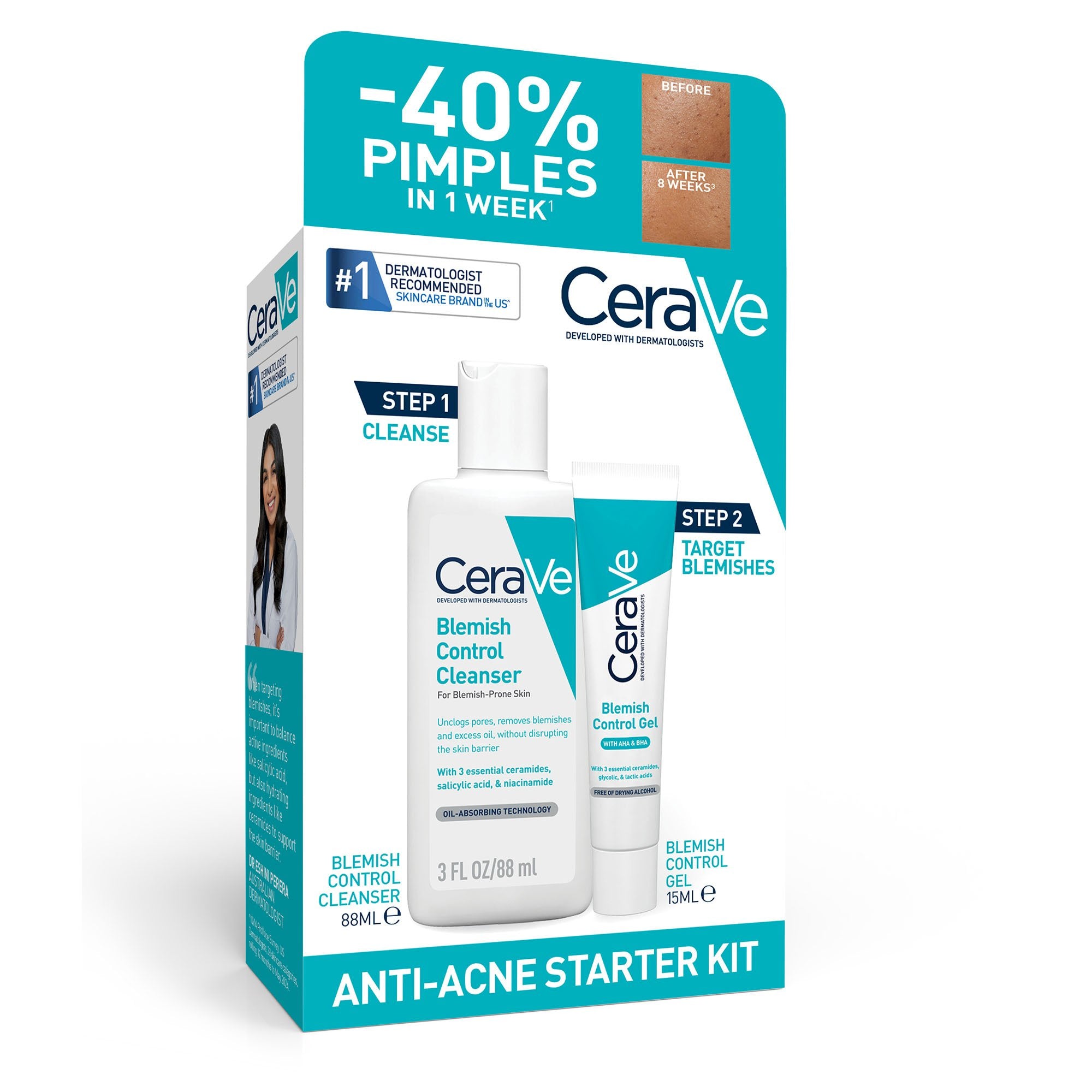Cerave Anti-Acne Starter Kit